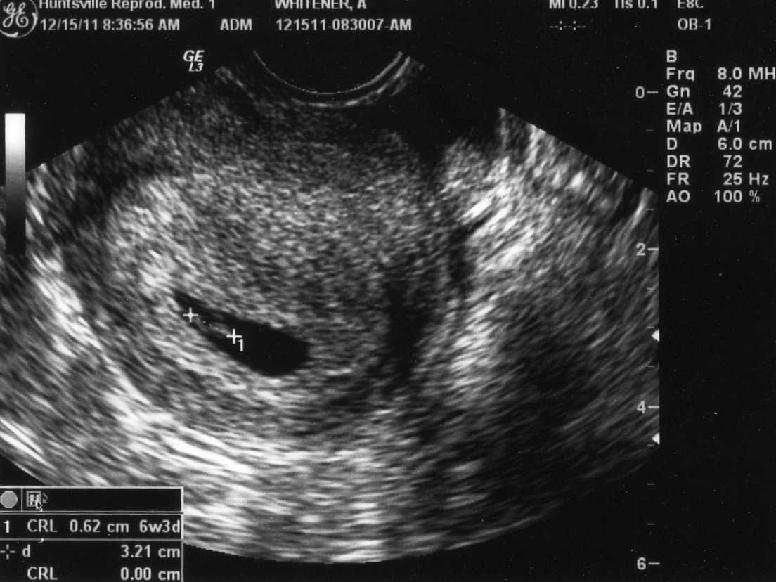 katy perry is dating