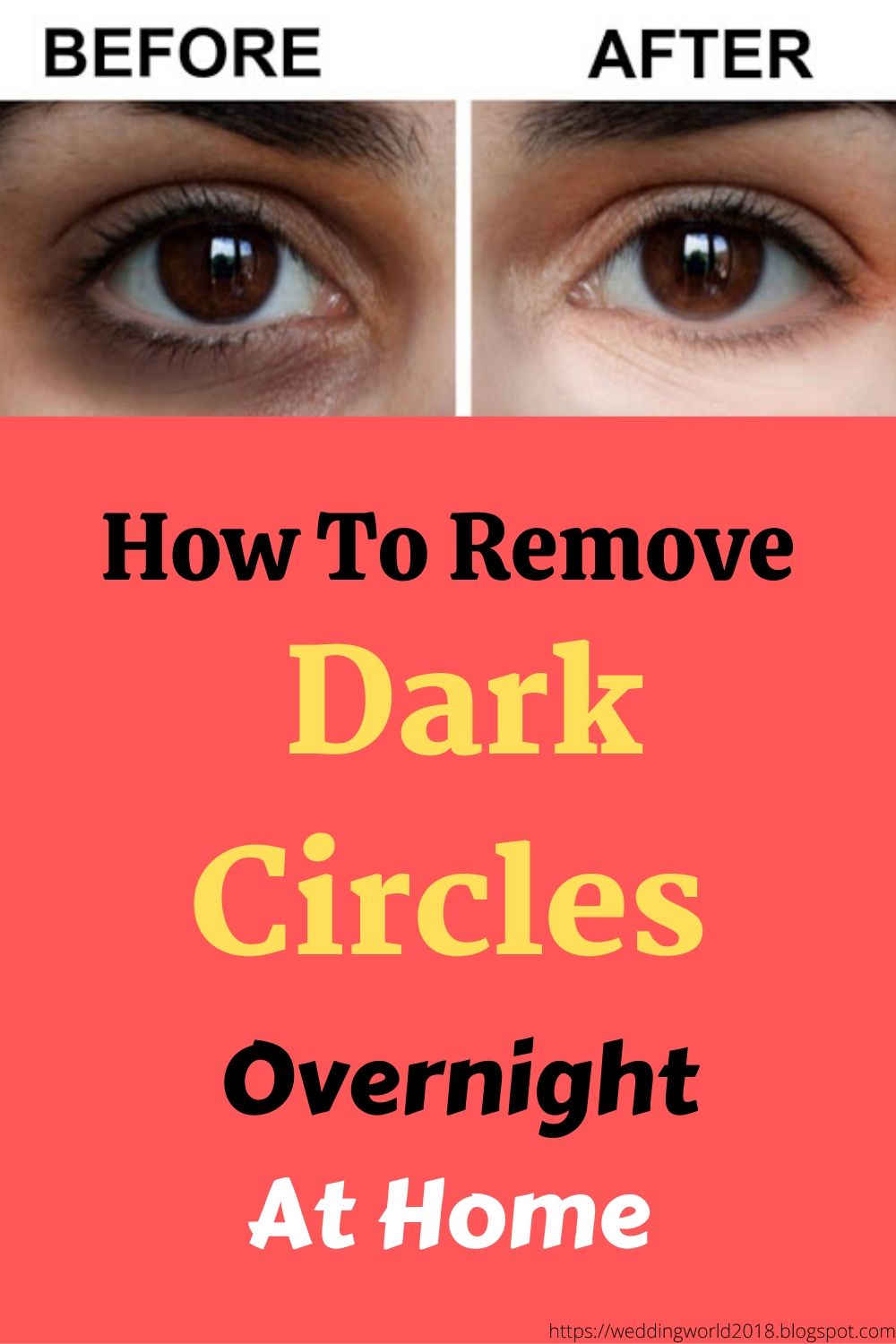 How to Get Rid of Dark Circles Overnight Home Remedies WEDDING AND