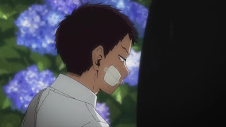 ヒロアカ アニメ 治崎廻 幼少期 オーバーホール CHISAKI KAI Overhaul 僕のヒーローアカデミア My Hero Academia