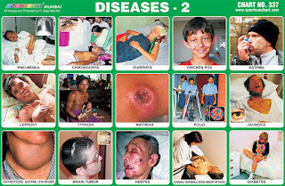 Disease Chart