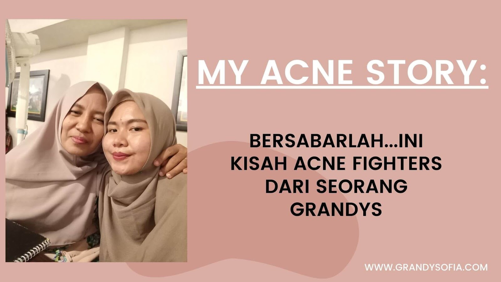 Cara Menghilangkan Jerawat Membandel: My Acne Story | Grandysofia