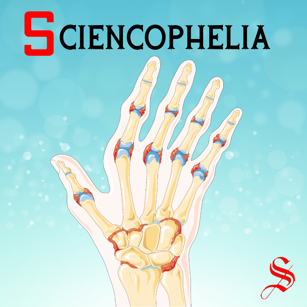 التهاب المفاصل الروماتيزمي