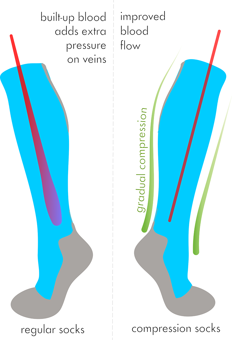 Torr PerformanceInspired Dress Socks Compression Socks Vs. Regular