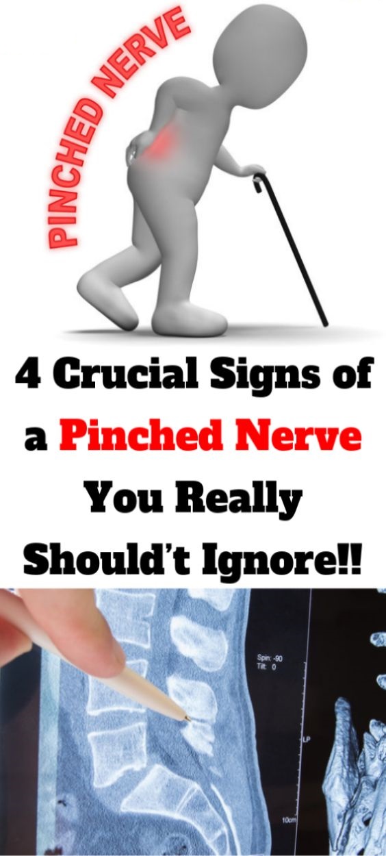 Healthy Discuss: 4 Crucial Signs of a Pinched Nerve You Really Should’t