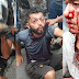 ASSISTA: Dupla assaltante recebe 'carinho' popular no Mutirão 