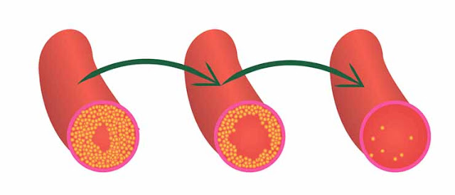 Lowers cholesterol Lowers cholesterol