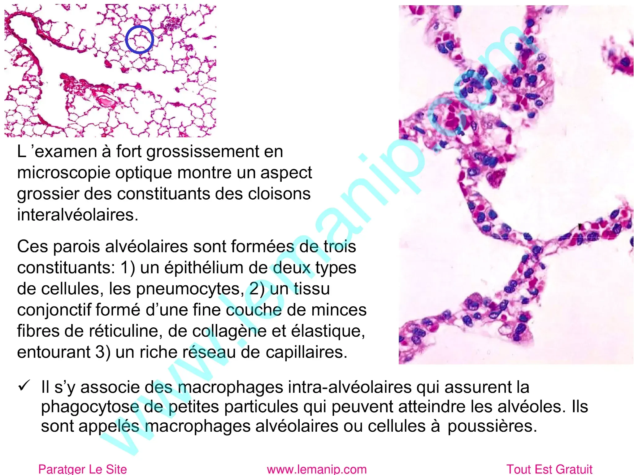 Parois alvéolaires