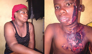 A Trader poured hot water on a 12-year-old house help over N100 (Photos)