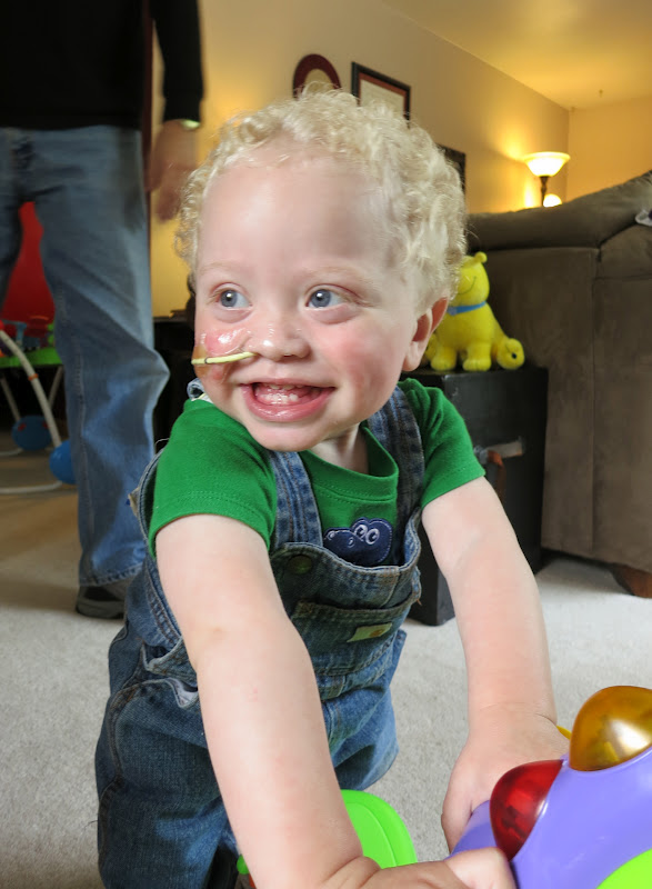 youtube feeding tube youtube feeding tube
