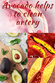 Avocado helps to clean artery