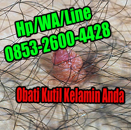 Aturan Minum Obat  Kutil Kelamin Super Ampuh