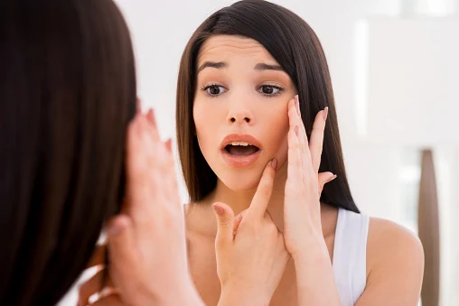 Advantages and disadvantages of acne treatment