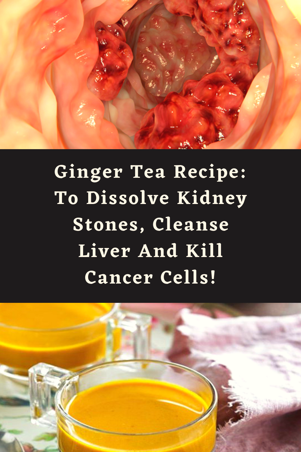 Ginger Tea Recipe To Dissolve Kidney Stones, Cleanse Liver And Kill