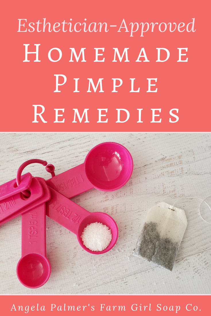 Want to learn how to get rid of a big pimple naturally? Make this simple dIY pimple remedy, with ingredients you already have in your kitchen, to quickly heal a big pimple fast. No need to pop, safe for your skin, and esthetician approved! By Angela Palmer at Farm Girl Soap Co.