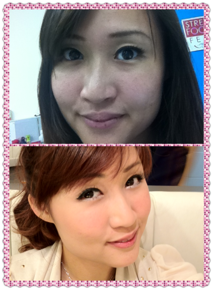 Beauty Lies in the Hands of the Beholder Vitamin C Drip or Jab, You Choose