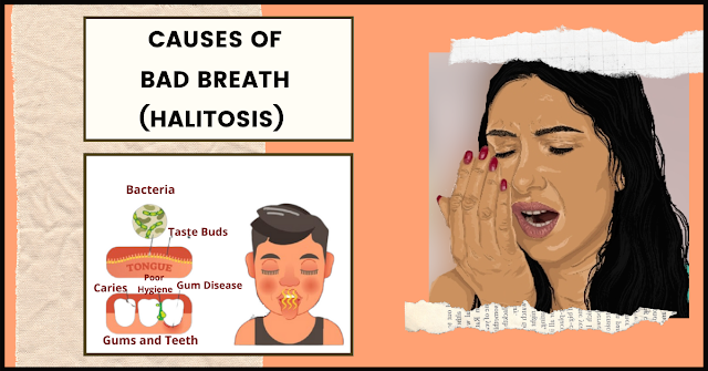 CAUSES OF BAD BREATH - HALITOSIS