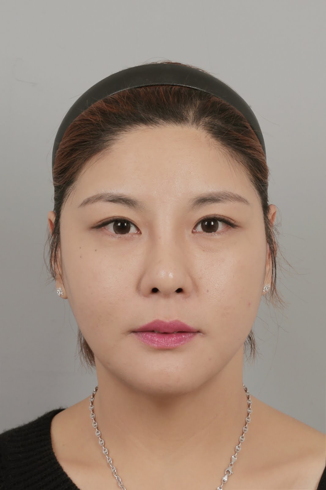 ID Hospital Korea [ID Hospital Korea Experiences] Anyone can have a