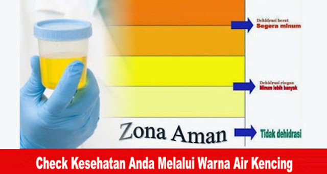 Check Kesehatan Anda Melalui Warna Air Kencing