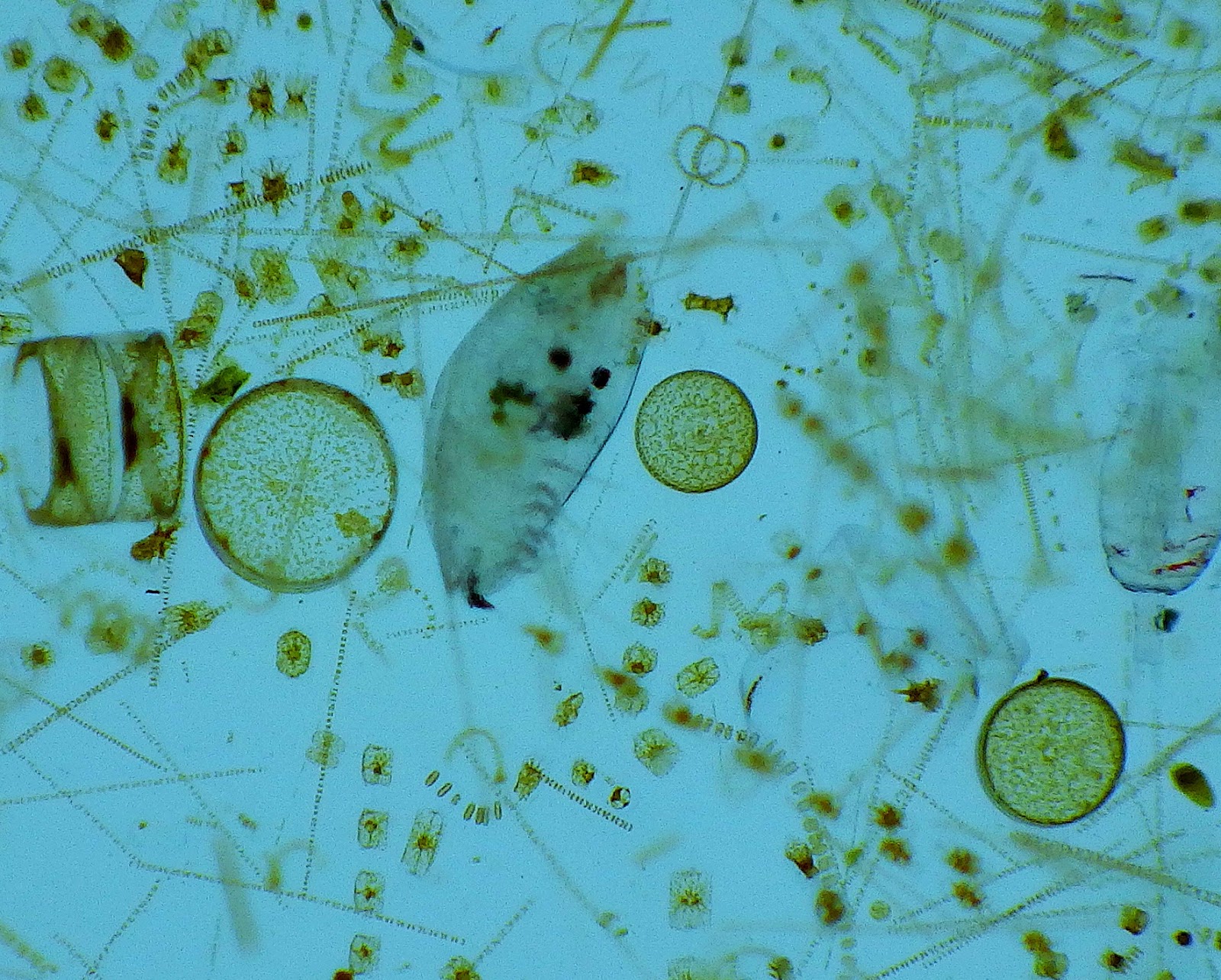 Фитопланктон образуют. Планктонные водоросли фитопланктон. Фитопланктон диатомовые водоросли. Фитопланктон нанопланктон зоопланктон. Планктон фото.