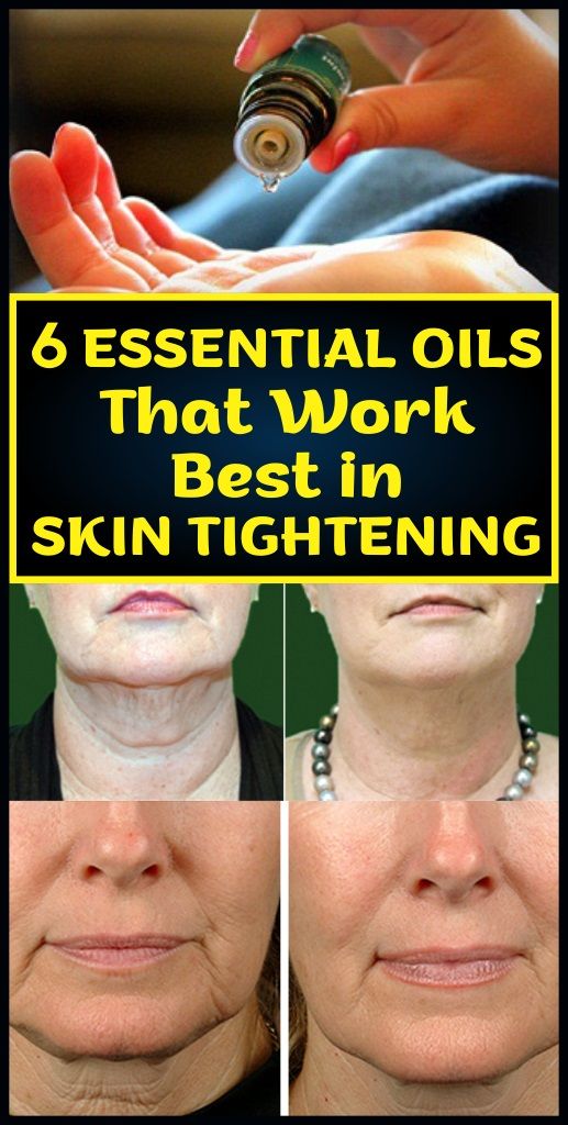 6 Essential Oils That Work Best in Skin Tightening Healthcare Important