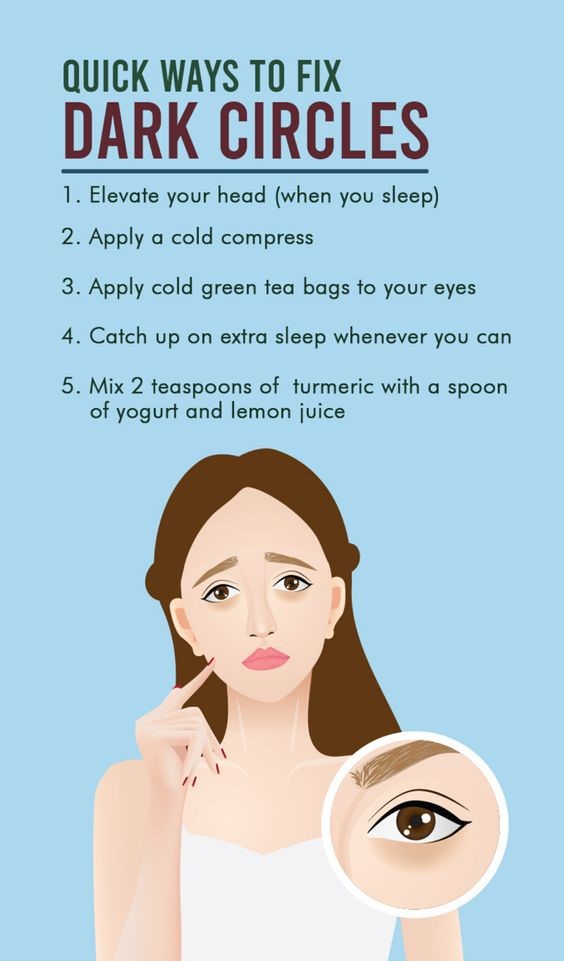 Dark Circles Under The Eyes Causes, Symptoms, And Treatment Options