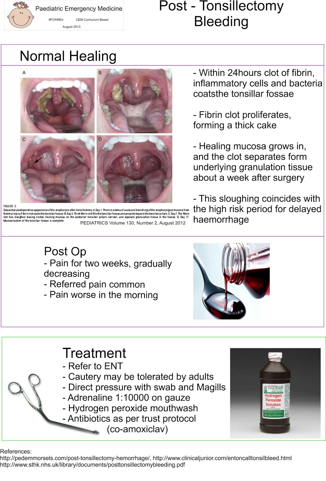 Paediatric Emergency Medicine: Apnoea, stridor and airway and obstruction