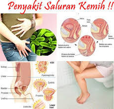  Obat Sakit Ketika Buang Air Kecil Di Ujung Penis secara alami