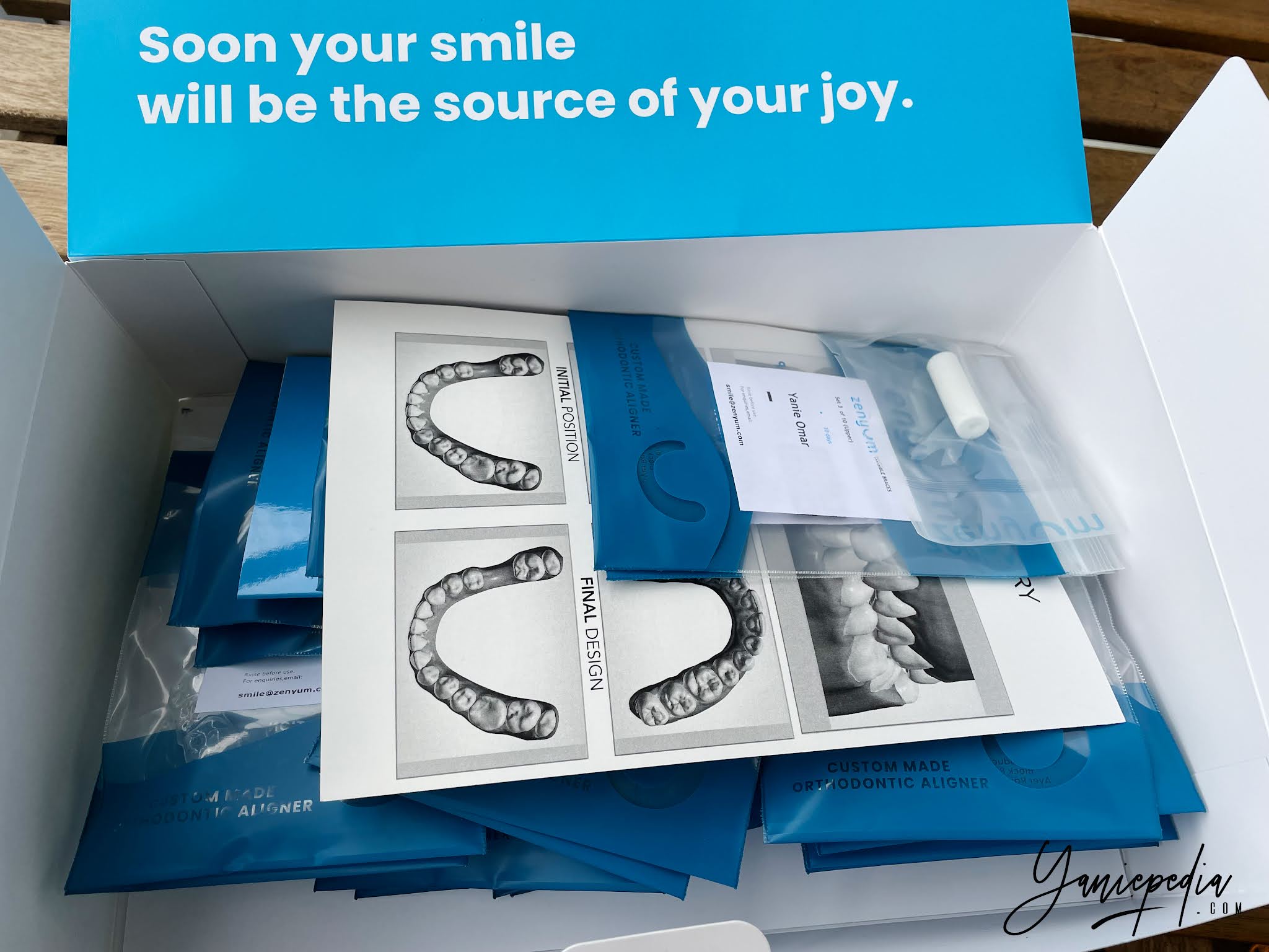 My ZENYUM Braces Part 2 Sesi Refinement (Penambahbaikan)