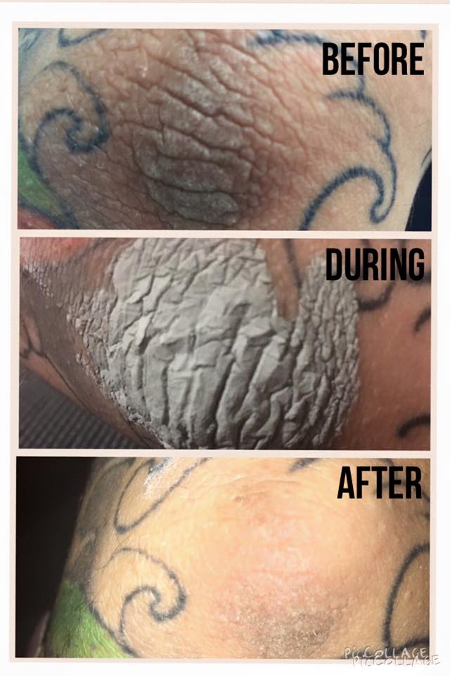 Beauty Box Say Goodbye to Dead Cells and Blackheads