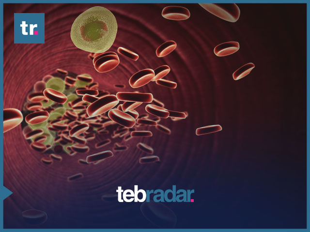 9 تجارب تساعد على خفض نسبة الكولسترول بسرعة في أسبوع