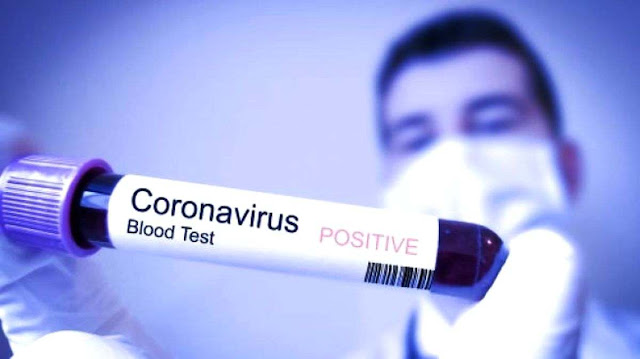 Korban Meninggal Dunia Akibat Virus Corona Mencapai 636 Orang