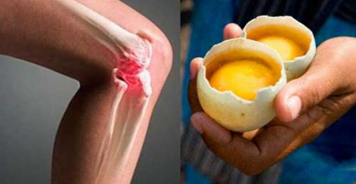 Regenerate Your Joints And Soothe The Pain Of Your Knees Using 2 Eggs