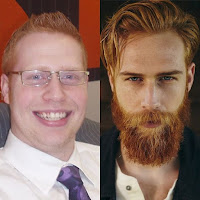 a vida antes e depois da barba