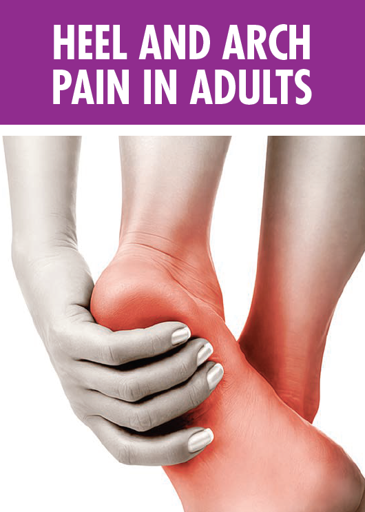 broward-county-s-podiatric-experts-heel-arch-pain-in-adults-a