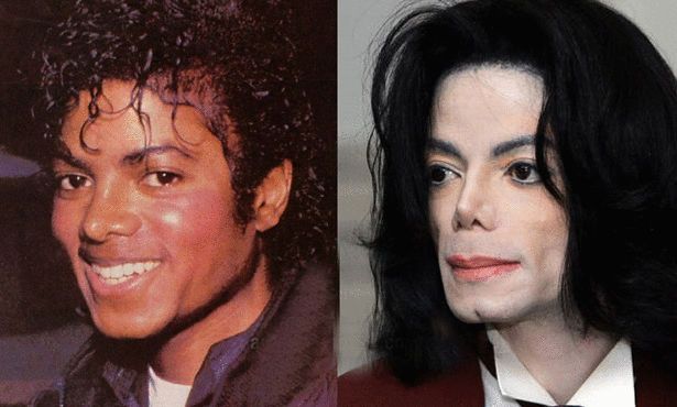 From lost childhood to extreme surgery: Michael Jackson's nose tells of
