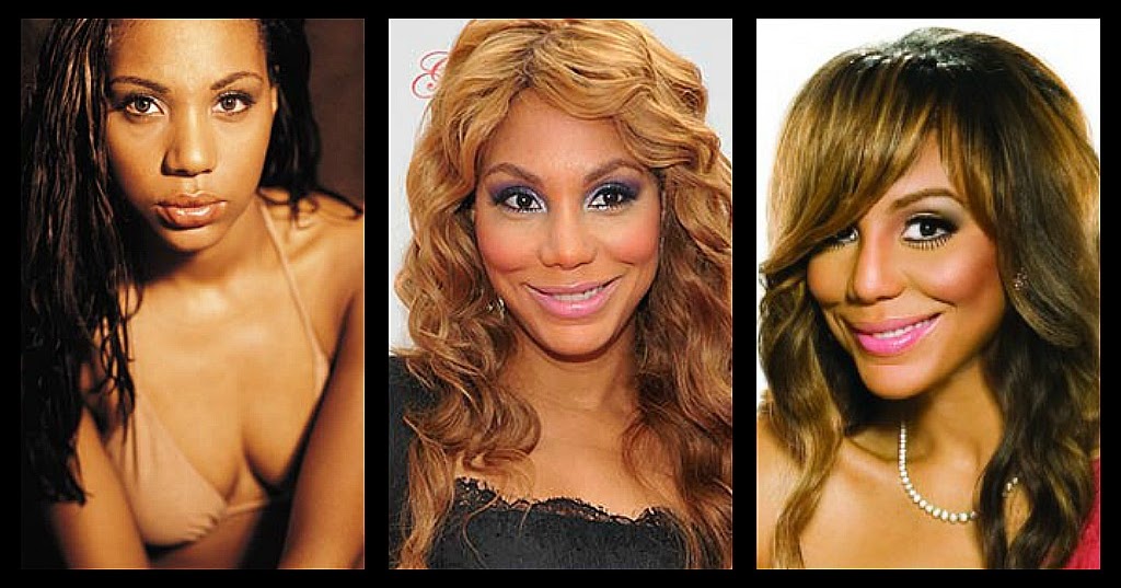 Topsi News Celebrity Plastic Surgery Before And After