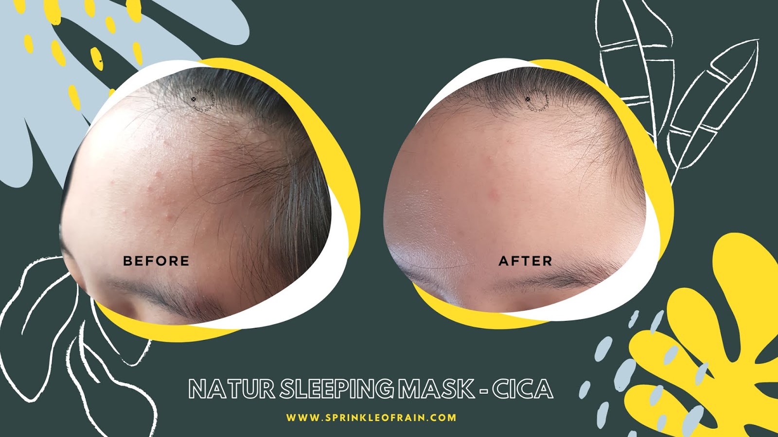 [REVIEW] Natur Sleeping Mask Cica & Witch Hazel untuk Kulit Bruntusan