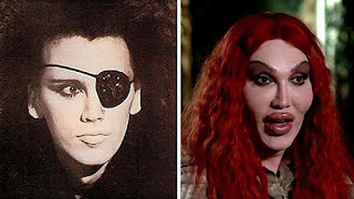 Pete Burns cause of death