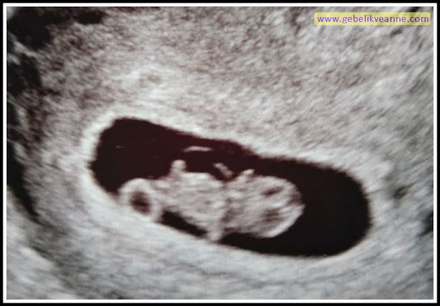 8 HAFTALIK GEBELİK (HAMİLELİK) ultrason GÖRÜNTÜSÜ
