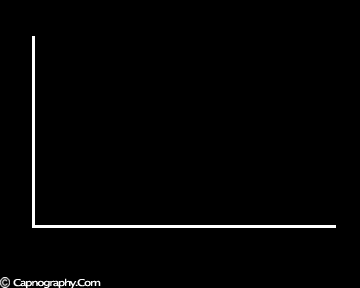 CAPNOGRAPHY TRONG GÂY MÊ Ở NGƯỜI LỚN CAPNOGRAPHY TRONG GÂY MÊ Ở NGƯỜI LỚN