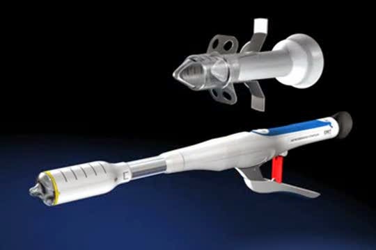 Info Kesehatan Indonesia: Usir Wasir Dengan Hemorroid Stapler