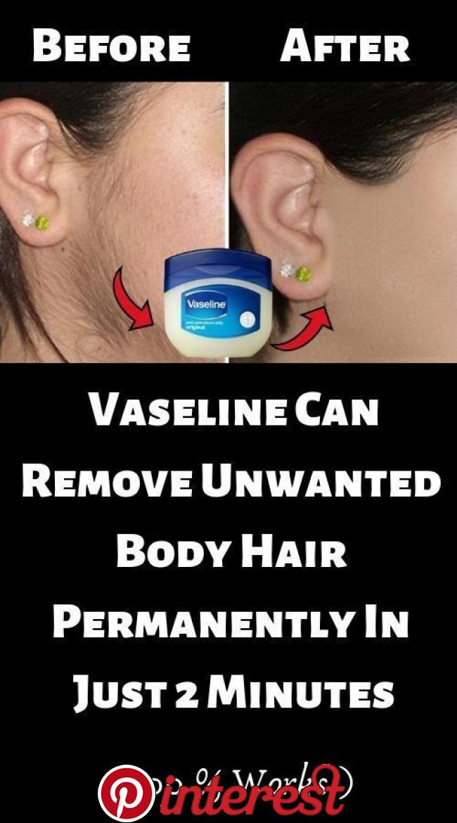 A Simple Vaseline Trick To Remove Unwanted Hair On The Body…