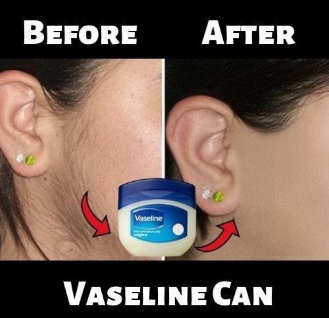 Vaseline trick for unwanted hair Clearance