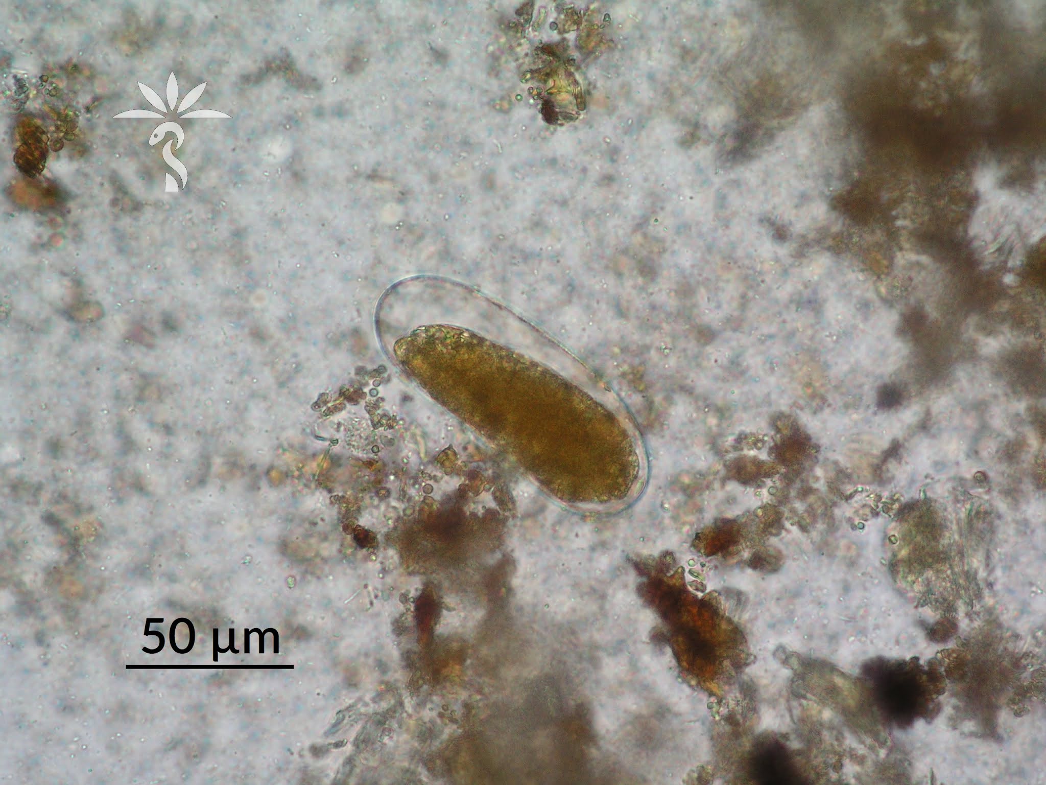 Rhabditiform Larvae: Understanding The Parasite Threat To Dogs - ez345kw