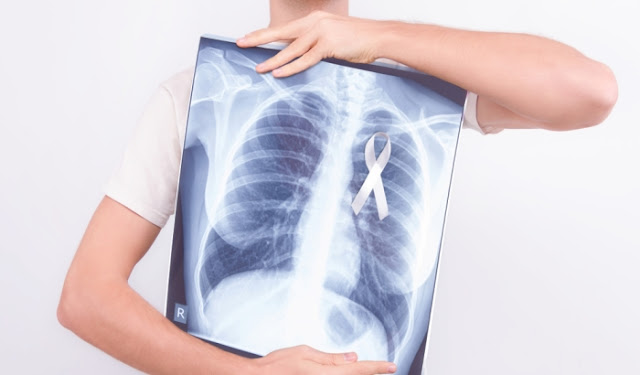 Cara Menjaga Kesehatan Paru-paru