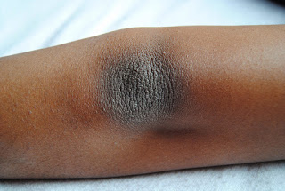 Best Way To Naturally Moisturize Dry Skin Best Way To Naturally Moisturize Dry Skin