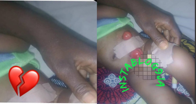 3-month-old baby hospitalized after being raped by unknown person in Nasarawa .