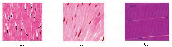 Latihansoaldanjawaban.blogspot.com: Soal IPA Rangka Otot Pesawat