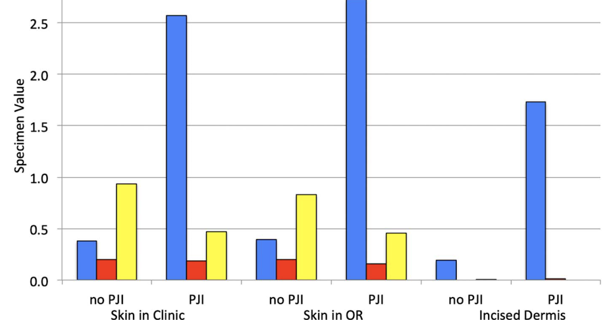 Shoulder Arthritis / Rotator Cuff Tears / Shoulder Pain Cutibacterium