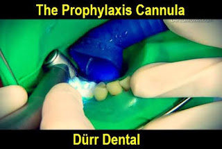 Durr Prophylaxis Cannula